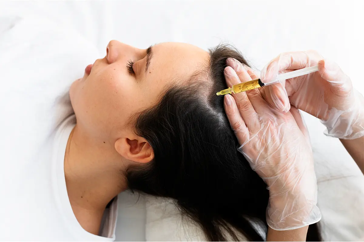 PRP Treatment