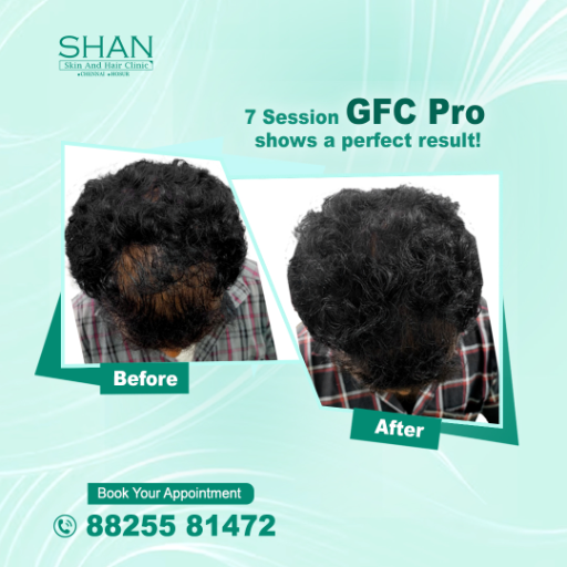 GFC Treatment